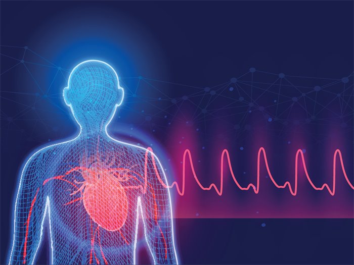 Scottish researchers use AI to predict patients’ risk of stroke