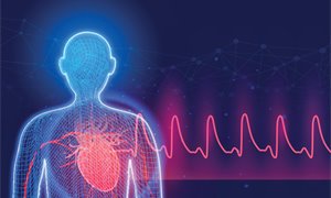 Scottish university to ‘revolutionise’ heart procedures